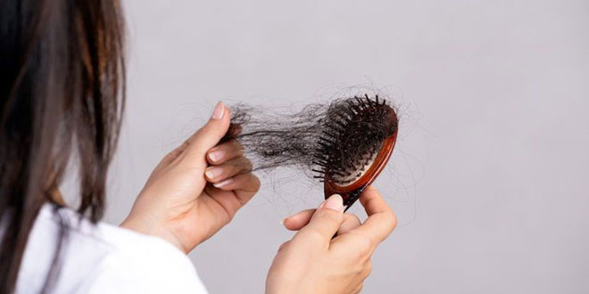 Causes of hair loss and prevention strategies 01 - دلایل ریزش مو و راهکارهای جلوگیری