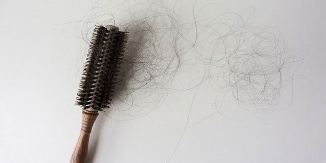 Causes of hair loss and prevention strategies 02 - دلایل ریزش مو و راهکارهای جلوگیری