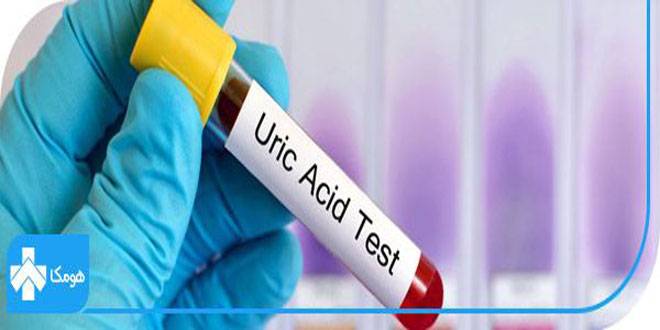 Control of gout and kidney stones by uric acid test 02 - کنترل نقرس و سنگ کلیه با آزمایش اسید اوریک