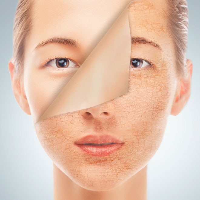 skin care More obligatory than night bread 9 - مراقبت از پوست؛ واجب‌تر از نان شب!