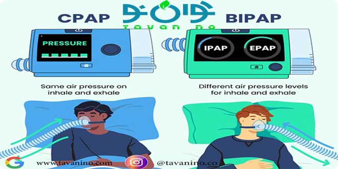 Working principles and clinical application of bi pep c pep and ventilator 0 - اصول کار و کاربرد بالینی بای پپ، سی پپ و ونتیلاتور