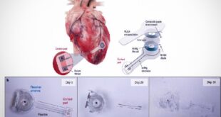 62956670 310x165 - قطعات الکترونیکی تجزیه‌پذیر برای مقاصد پزشکی وارد بدن می‌شوند