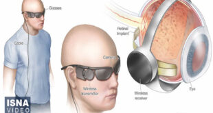 62969552 310x165 - ویدیو/ ادعای جدید ایلان ماسک؛ بازگشت بینایی به افراد نابینا